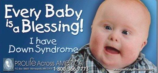 DownSyndrome.jpg